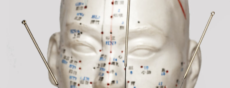 Acupuncture needles